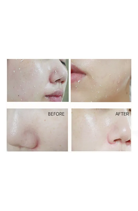 [ANJO] Snail Skin Soft Peeling Gel (180mL /6.08fl.oz)